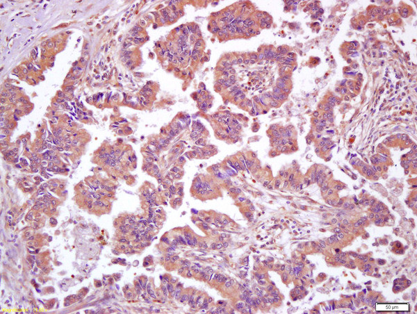 HSF1 Antibody in Immunohistochemistry (Paraffin) (IHC (P))