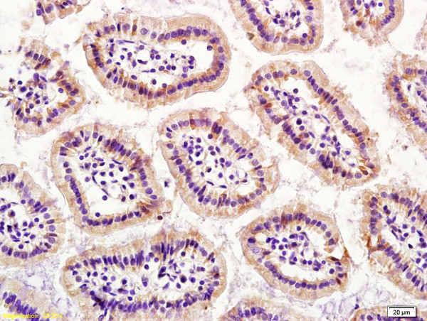 S100A4 Antibody in Immunohistochemistry (Paraffin) (IHC (P))
