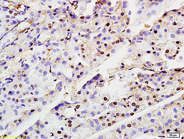 ASF1A Antibody in Immunohistochemistry (Paraffin) (IHC (P))
