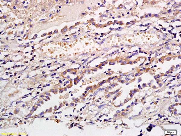 CD1a/Cortical thymocyte antigen CD1A Antibody in Immunohistochemistry (Paraffin) (IHC (P))