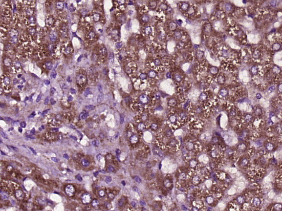 SCD1 Antibody in Immunohistochemistry (Paraffin) (IHC (P))
