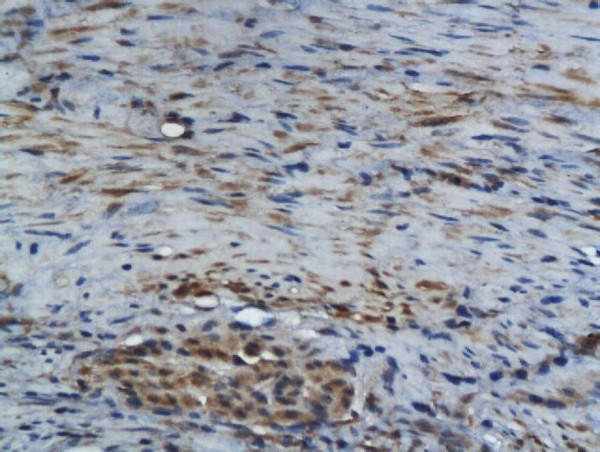 GM-CSF Antibody in Immunohistochemistry (Paraffin) (IHC (P))
