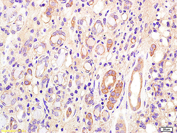CD75 Antibody in Immunohistochemistry (Paraffin) (IHC (P))