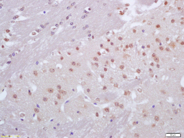 CRX1 Antibody in Immunohistochemistry (Paraffin) (IHC (P))