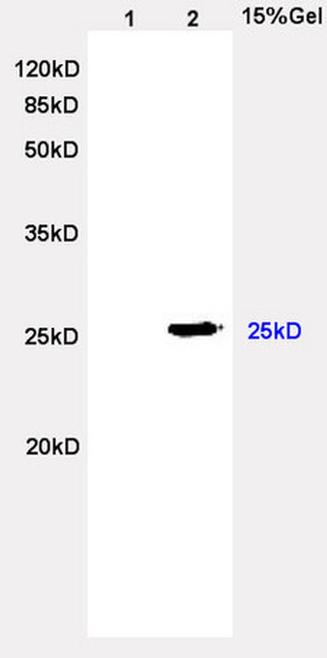 Lambda Light Chain Antibody in Western Blot (WB)