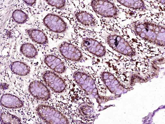 MSH6 Antibody in Immunohistochemistry (Paraffin) (IHC (P))