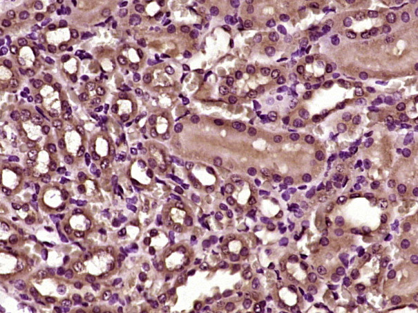 Villin Antibody in Immunohistochemistry (Paraffin) (IHC (P))