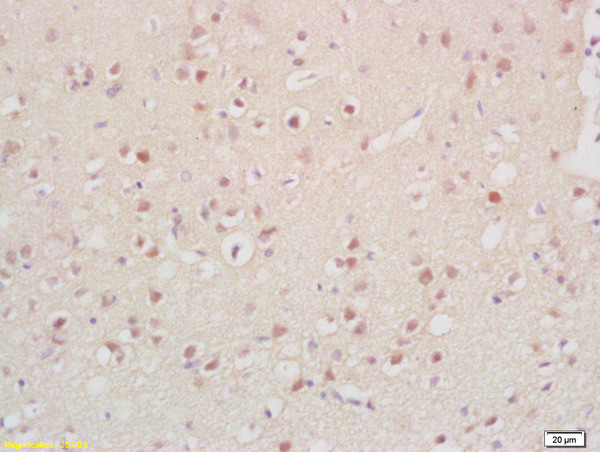 Cyclin G2 Antibody in Immunohistochemistry (Paraffin) (IHC (P))