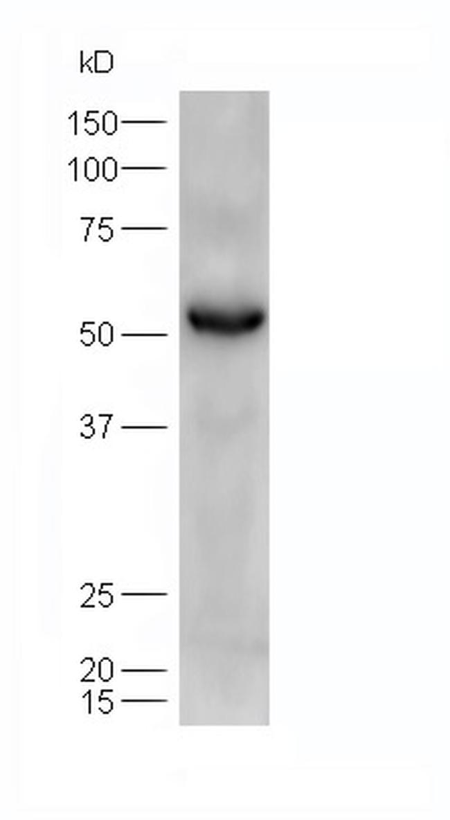 ATGL/Adipose Triglyceride Lipase Antibody in Western Blot (WB)