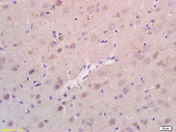 RHEB Antibody in Immunohistochemistry (Paraffin) (IHC (P))