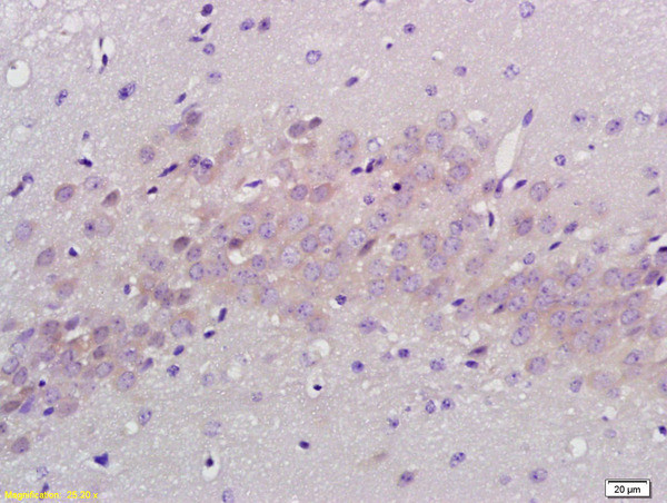 PABP Antibody in Immunohistochemistry (Paraffin) (IHC (P))