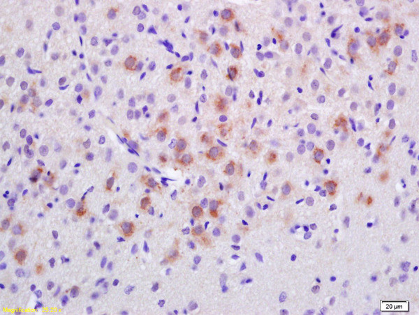 EPS8 Antibody in Immunohistochemistry (Paraffin) (IHC (P))