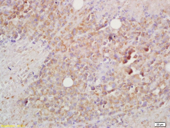 BCMA/CD269 Antibody in Immunohistochemistry (Paraffin) (IHC (P))
