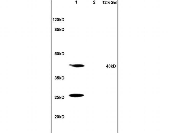 HSD17B2 Antibody in Western Blot (WB)