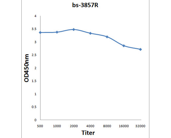SSDD/Steroid sulfatase Antibody in ELISA (ELISA)