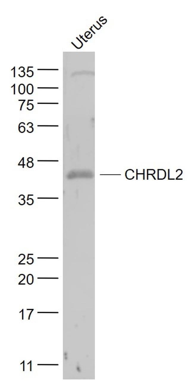CHRDL2 Antibody in Western Blot (WB)