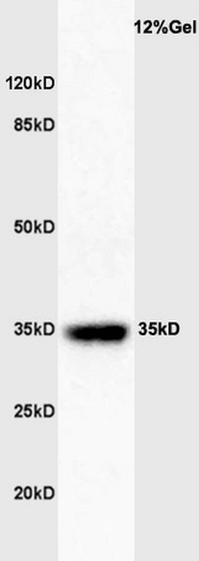 GATA-1 Antibody in Western Blot (WB)