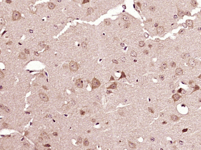 ATG4A Antibody in Immunohistochemistry (Paraffin) (IHC (P))