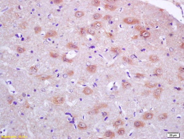 PRDX1 Antibody in Immunohistochemistry (Paraffin) (IHC (P))