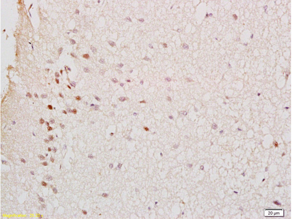 GTPBP10 Antibody in Immunohistochemistry (Paraffin) (IHC (P))