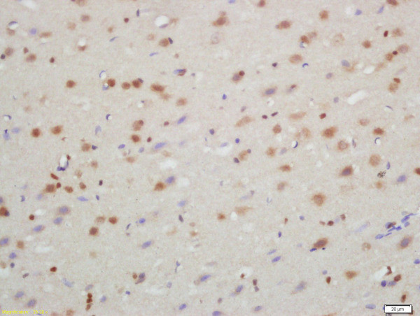 TXNIP Antibody in Immunohistochemistry (Paraffin) (IHC (P))