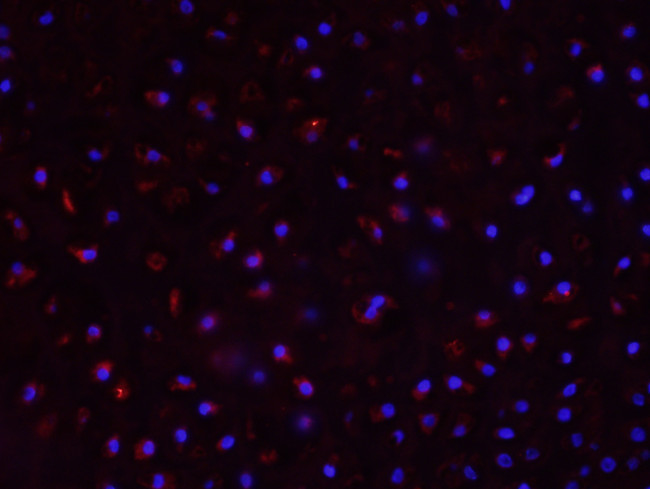 CYP11B1 Antibody in Immunohistochemistry (Paraffin) (IHC (P))