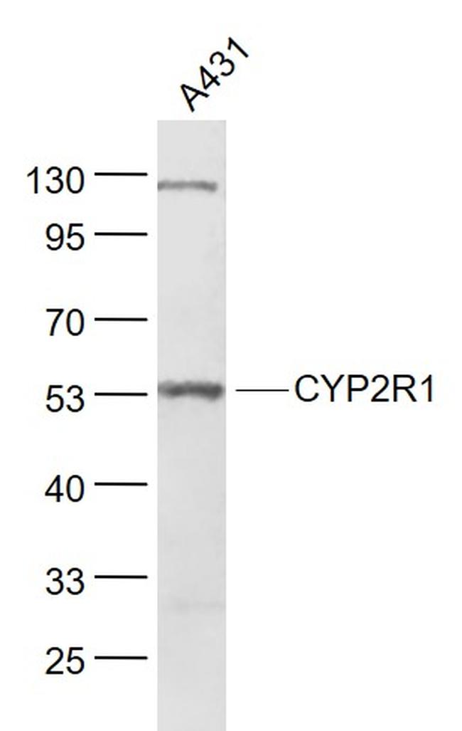 CYP2R1 Antibody in Western Blot (WB)