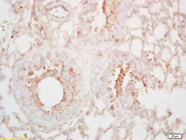 LTA4H Antibody in Immunohistochemistry (Paraffin) (IHC (P))