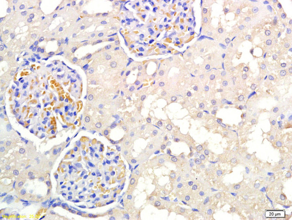 PNMT Antibody in Immunohistochemistry (Paraffin) (IHC (P))