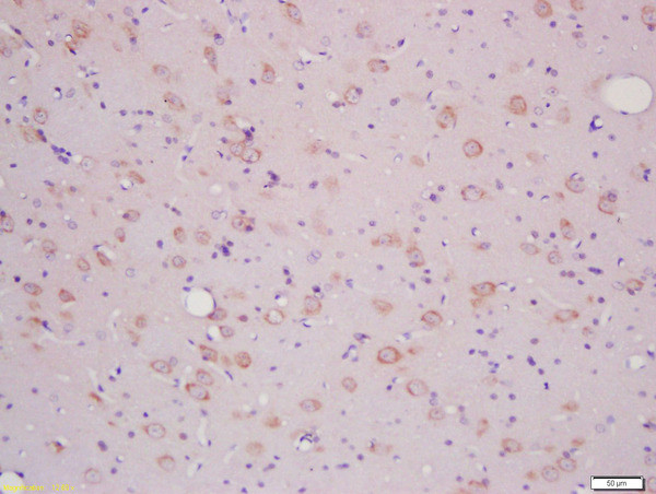 SLCO2B1/OATPB Antibody in Immunohistochemistry (Paraffin) (IHC (P))