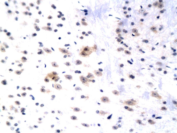 WIF1 Antibody in Immunohistochemistry (Paraffin) (IHC (P))