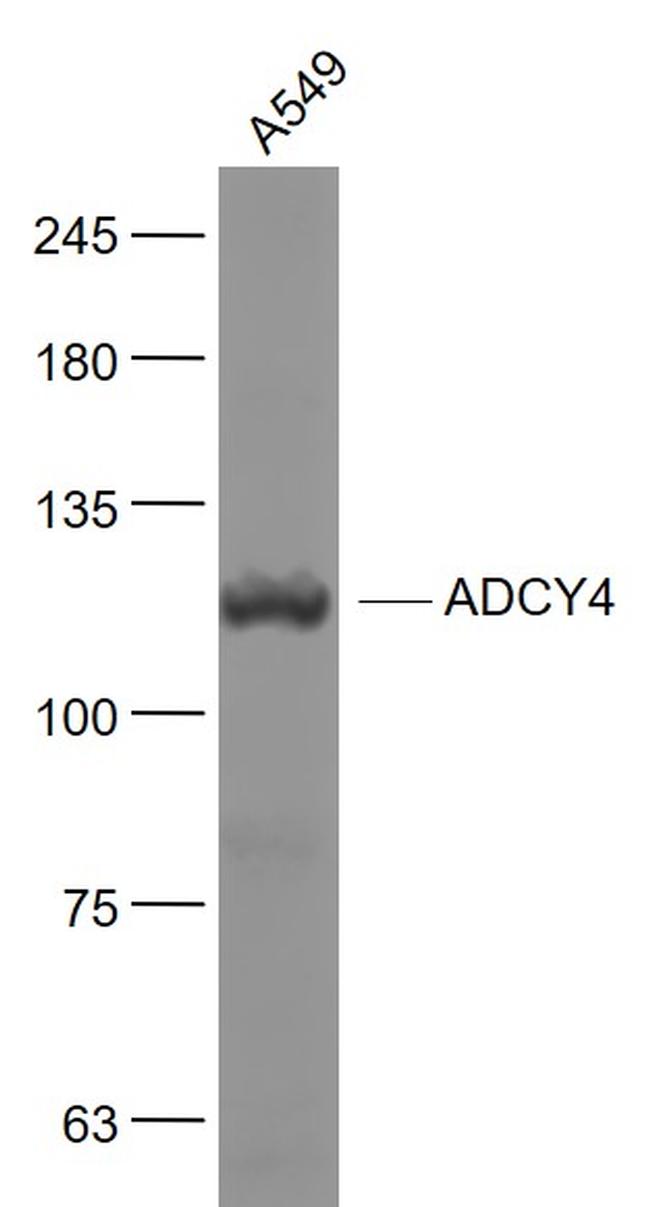 ADCY4 Antibody in Western Blot (WB)