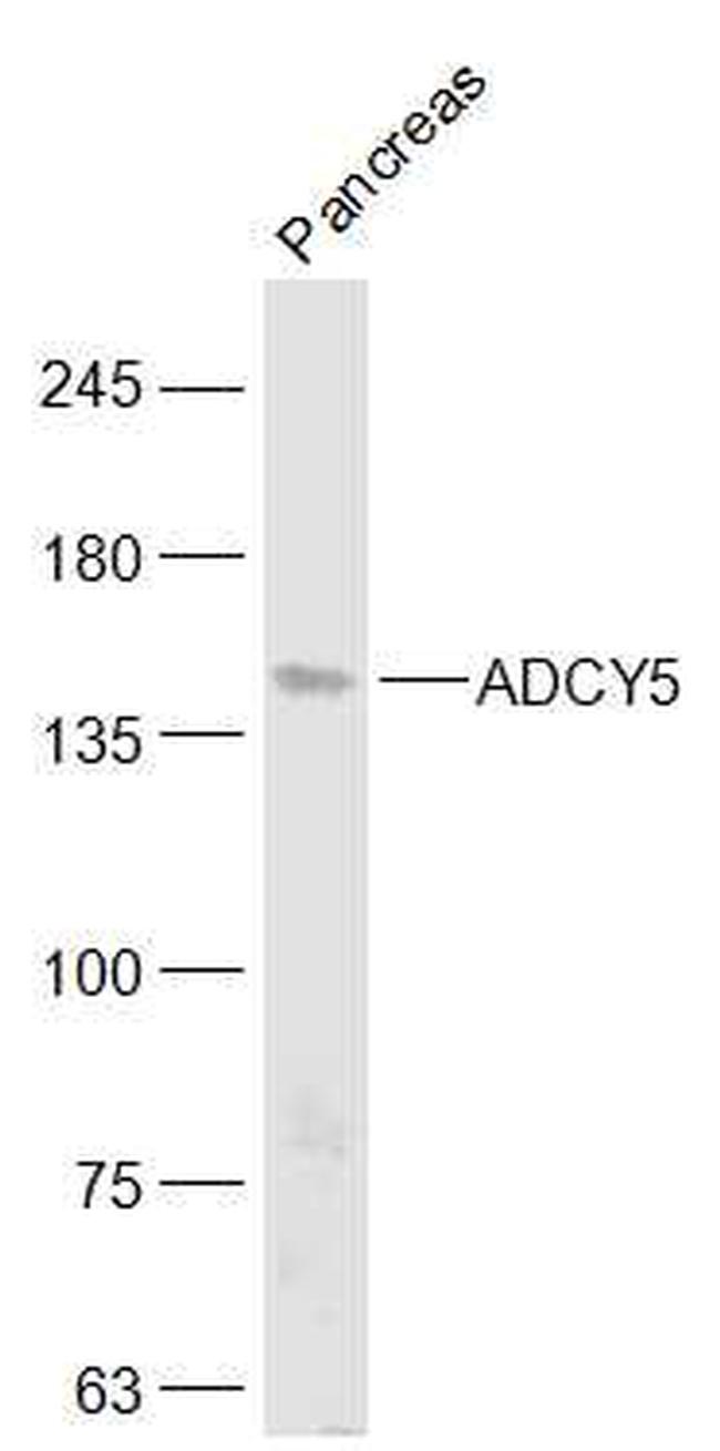 ADCY5 Antibody in Western Blot (WB)