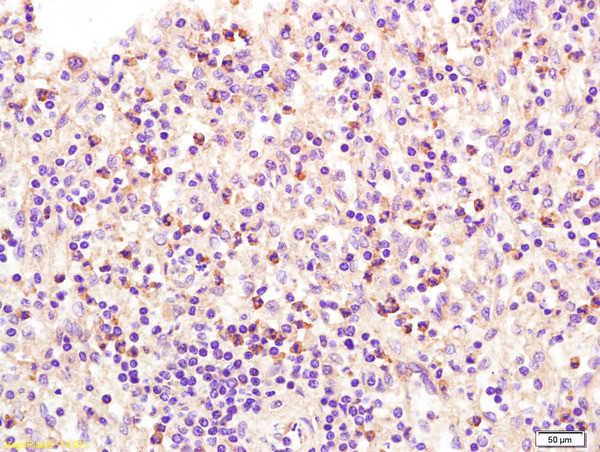 ADCY6 Antibody in Immunohistochemistry (Paraffin) (IHC (P))