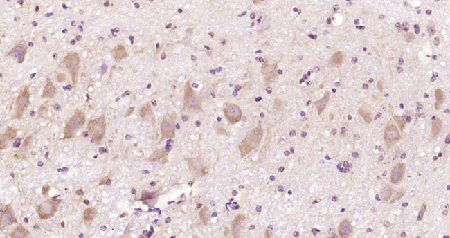 CACNA1A/Cav2.1 Antibody in Immunohistochemistry (Paraffin) (IHC (P))