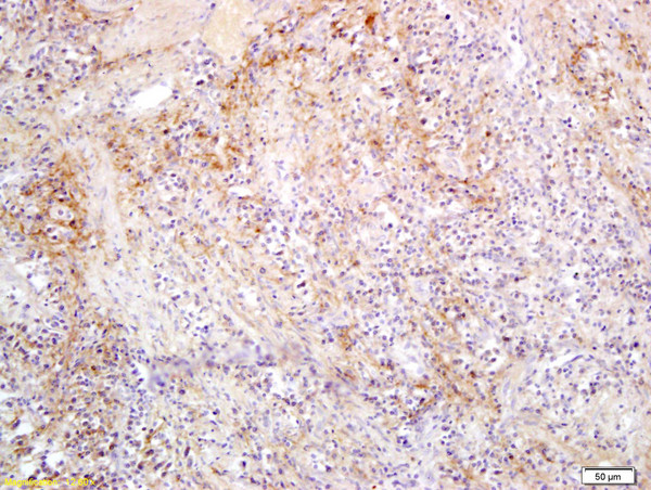 SLC27A2/ACSVL1 Antibody in Immunohistochemistry (Paraffin) (IHC (P))