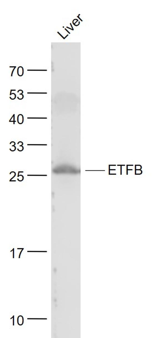 ETFB Antibody in Western Blot (WB)