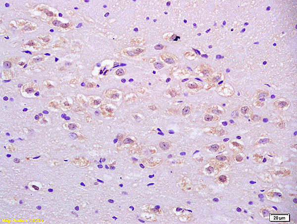 IDH3A Antibody in Immunohistochemistry (Paraffin) (IHC (P))