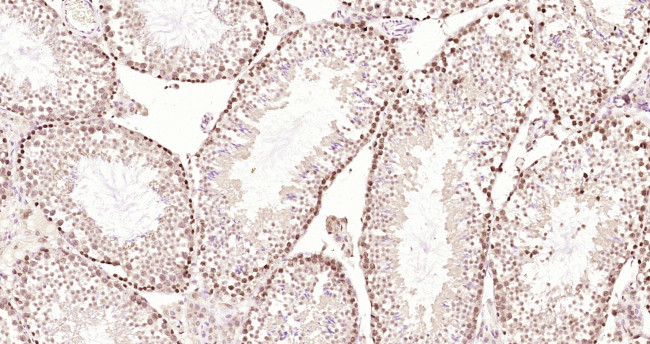 LYK5 Antibody in Immunohistochemistry (Paraffin) (IHC (P))