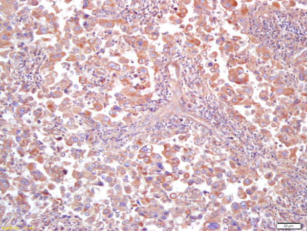MT-ND5 Antibody in Immunohistochemistry (Paraffin) (IHC (P))