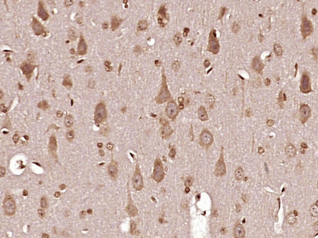 MT-ND6 Antibody in Immunohistochemistry (Paraffin) (IHC (P))