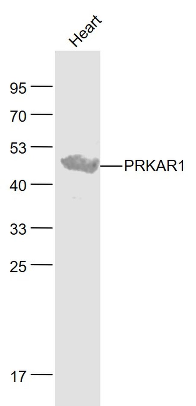 PRKAR1 Antibody in Western Blot (WB)