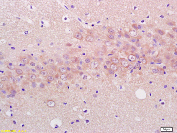 ENO3 Antibody in Immunohistochemistry (Paraffin) (IHC (P))