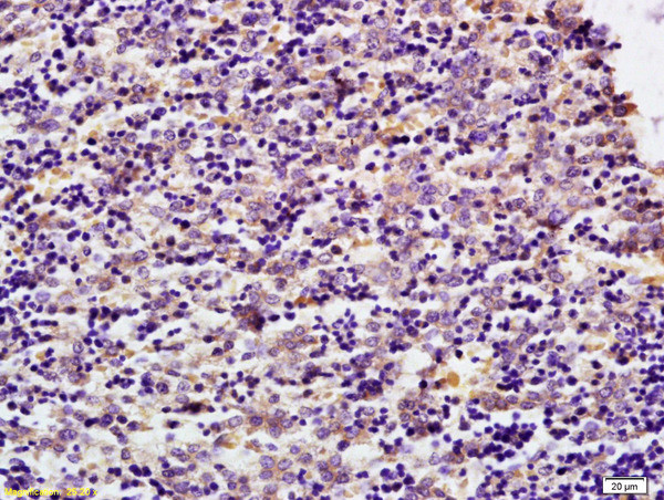 MDH1 Antibody in Immunohistochemistry (Paraffin) (IHC (P))