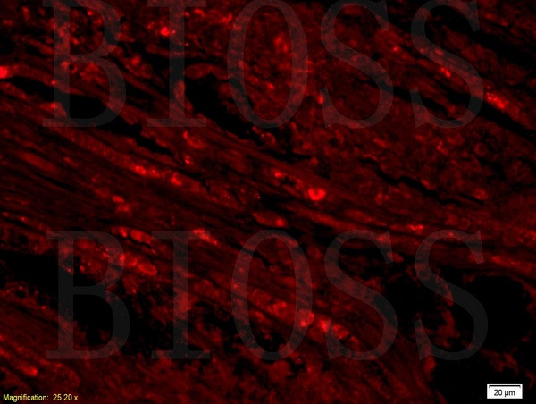 SLC25A10 Antibody in Immunohistochemistry (Paraffin) (IHC (P))