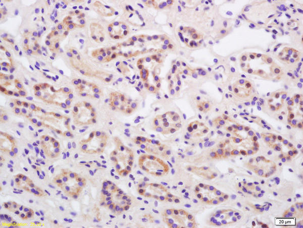 Phospho-HER2 (Thr686) Antibody in Immunohistochemistry (Paraffin) (IHC (P))