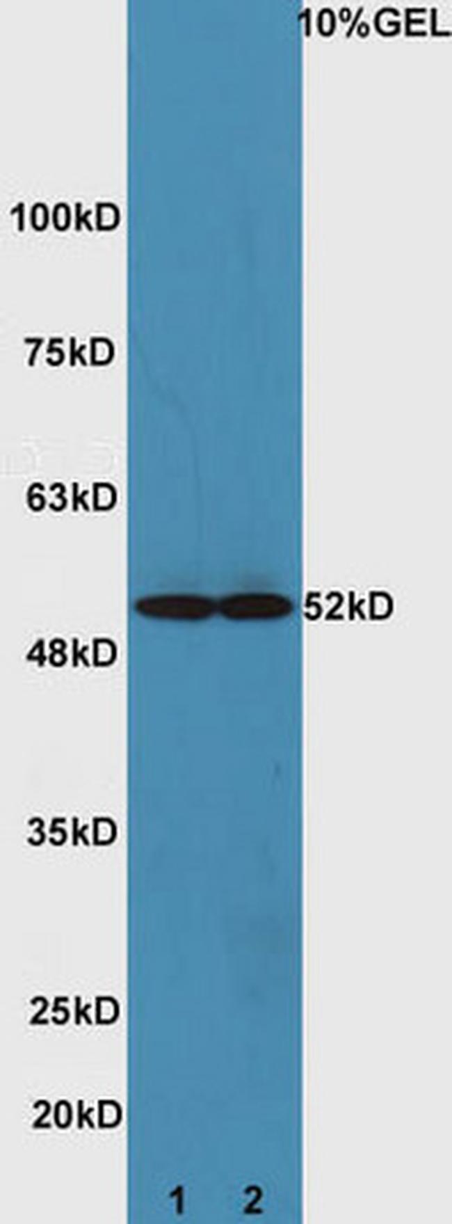 ATG4D Antibody in Western Blot (WB)