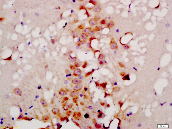 ATG9B Antibody in Immunohistochemistry (Paraffin) (IHC (P))
