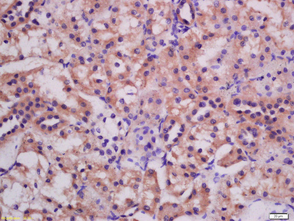 ATG3 Antibody in Immunohistochemistry (Paraffin) (IHC (P))
