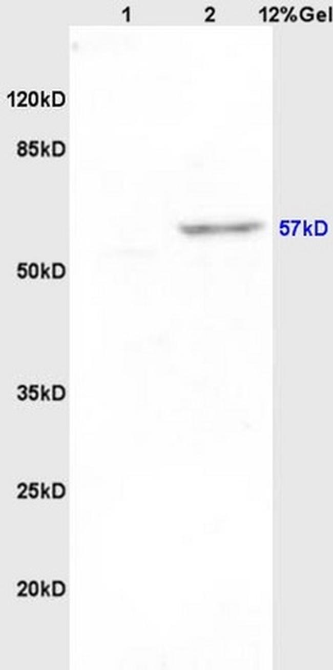 Pancreatic Amylase Antibody in Western Blot (WB)